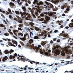 Histone H2A.X antibody (GTX108272)